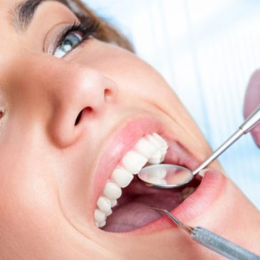 How to Make Your Dental Sealants Long-Lasting? – Philadelphia, PA