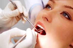 Answering Questions About Dental Bonding